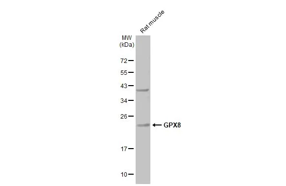 Rat tissue extract (50 μg) was separated by 12% SDS-PAGE, and the membrane was blotted with GPX8 antibody (GTX125992) diluted at 1:1000. The HRP-conjugated anti-rabbit IgG antibody (GTX213110-01) was used to detect the primary antibody.
