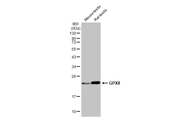 Various tissue extracts (50 μg) were separated by 12% SDS-PAGE, and the membrane was blotted with GPX8 antibody (GTX125992) diluted at 1:1000. The HRP-conjugated anti-rabbit IgG antibody (GTX213110-01) was used to detect the primary antibody.