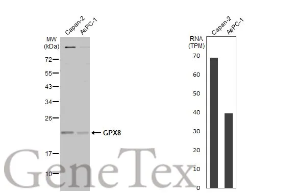 Various whole cell extracts (30 μg) were separated by 12% SDS-PAGE, and the membrane was blotted with GPX8 antibody (GTX125992) diluted at 1:1000. The HRP-conjugated anti-rabbit IgG antibody (GTX213110-01) was used to detect the primary antibody. Corresponding RNA expression data for the same cell lines are based on Human Protein Atlas program.