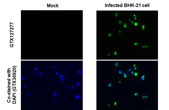 Dengue virus Envelope protein antibody detects Dengue virus Envelope protein protein at cytoplasm by immunohistochemical analysis. Sample: BHK-21 cells mock (left) and infected with Dengue virus (right) FFPE Cell Pellet Block. Green: Dengue virus Envelope protein stained by Dengue virus Envelope protein antibody (GTX127277) diluted at 1:1000. Antigen Retrieval: Citrate buffer, pH 6.0, 15 min