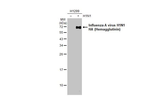 Non-infected (–) and infected (+) H1299 whole cell extracts (5 μg) were separated by 12% SDS-PAGE, and the membrane was blotted with Influenza A virus H1N1 HA (Hemagglutinin) antibody (GTX127295) diluted at 1:1000. The HRP-conjugated anti-rabbit IgG antibody (GTX213110-01) was used to detect the primary antibody.