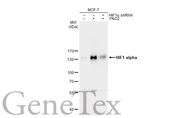 HIF1 alpha antibody detects HIF1 alpha protein at nucleus by immunofluorescent analysis.