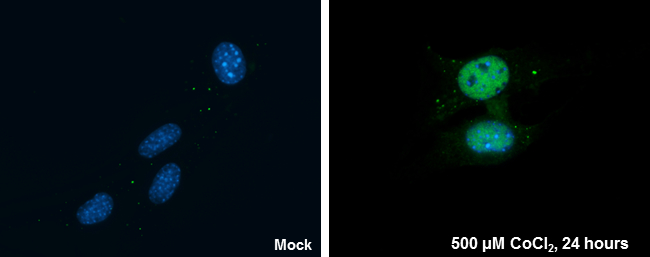 Anti-HIF1 alpha antibody (GTX127309) | GeneTex