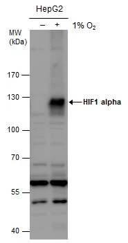 あ　H I F Anti-HIF1 alpha antibody (GTX127309) | GeneTex