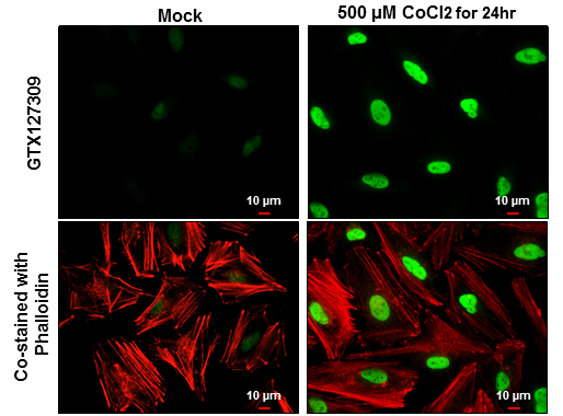 HIF1 alpha antibody detects HIF1 alpha protein at nucleus by immunofluorescent analysis.