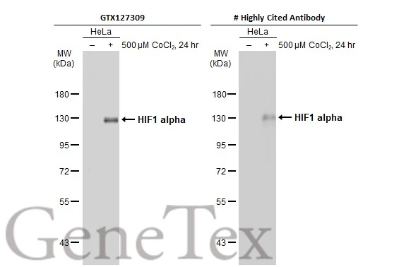 Untreated (–) and treated (+) HeLa whole cell extracts (30 μg) were separated by 7.5% SDS-PAGE, and the membrane was blotted with HIF1 alpha antibody (GTX127309) diluted at 1:1000. The HRP-conjugated anti-rabbit IgG antibody (GTX213110-01) was used to detect the primary antibody.