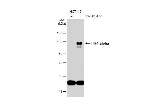 Anti-HIF1 alpha antibody (GTX127309) | GeneTex