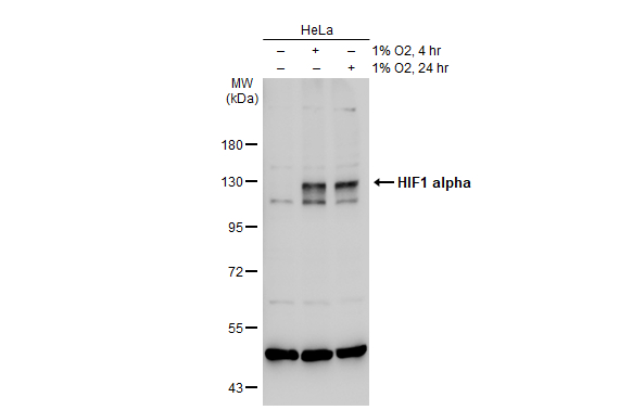 Untreated (–) and treated (+) HeLa whole cell extracts (30 μg) were separated by 7.5% SDS-PAGE, and the membrane was blotted with HIF1 alpha antibody (GTX127309) diluted at 1:1000. The HRP-conjugated anti-rabbit IgG antibody (GTX213110-01) was used to detect the primary antibody.