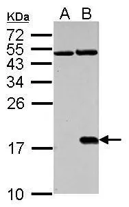Histone H2A.X (phospho Ser139) antibody detects H2AFX protein in cisplatin-treated samples by western blot analysis.