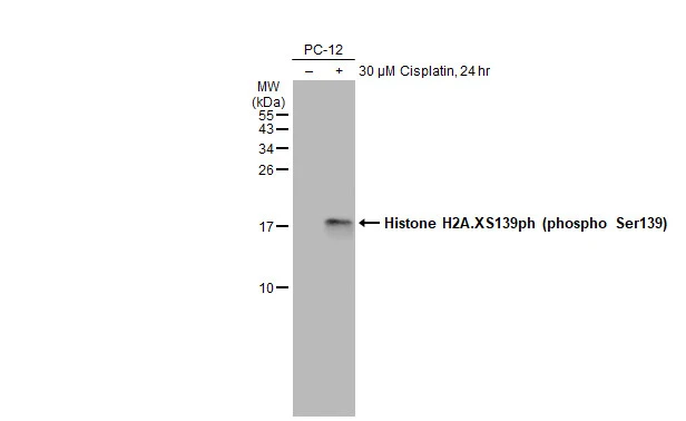 100％品質 H2A.XS139ph Anti-Histone (phospho antibody Ser139) ソフトドリンク