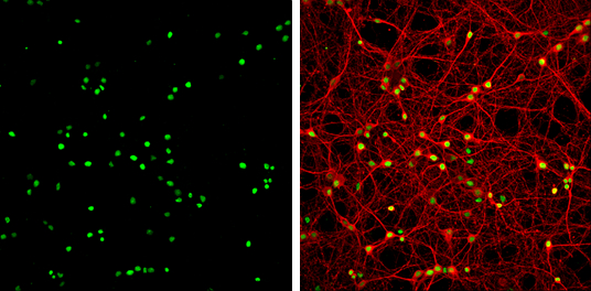 HMGB1 antibody detects HMGB1 protein at nucleus by immunofluorescent analysis. Sample: DIV9 rat E18 primary cortical neurons were fixed in 4% paraformaldehyde at RT for 15 min. Green: HMGB1 protein stained by HMGB1 antibody (GTX127344) diluted at 1:500. Red: beta Tubulin 3/ Tuj1, a neuron cell marker, stained by beta Tubulin 3/ Tuj1 antibody [GT11710] (GTX631836) diluted at 1:500.