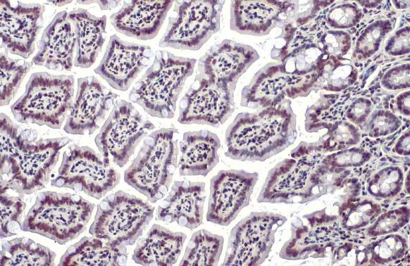 HMGB1 antibody detects HMGB1 protein at nucleus by immunohistochemical analysis. Sample: Paraffin-embedded mouse colon. HMGB1 stained by HMGB1 antibody (GTX127344) diluted at 1:1000. Antigen Retrieval: Citrate buffer, pH 6.0, 15 min