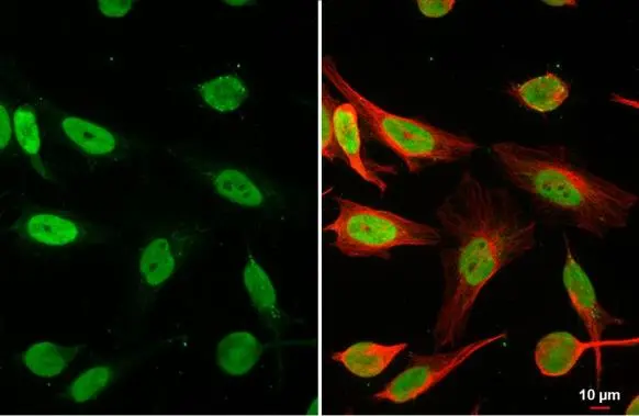 HMGB1 antibody detects HMGB1 protein at nucleus by immunofluorescent analysis. Sample: HeLa cells were fixed in 4% paraformaldehyde at RT for 15 min. Green: HMGB1 stained by HMGB1 antibody (GTX127344) diluted at 1:500. Red: alpha Tubulin, a cytoskeleton marker, stained by alpha Tubulin antibody [GT114] (GTX628802) diluted at 1:1000.