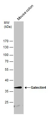 Galectin 4 antibody