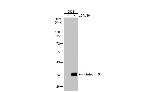 Non-transfected (–) and transfected (+) 293T whole cell extracts (30 μg) were separated by 10% SDS-PAGE, and the membrane was blotted with Galectin 9 antibody (GTX127353) diluted at 1:2500. The HRP-conjugated anti-rabbit IgG antibody (GTX213110-01) was used to detect the primary antibody. Non-transfected (–) and transfected (+) 293T whole cell extracts (30 μg) were separated by 10% SDS-PAGE, and the membrane was blotted with Galectin 9 antibody (GTX127353) diluted at 1:2500. The HRP-conjugated anti-rabbit IgG antibody (GTX213110-01) was used to detect the primary antibody.