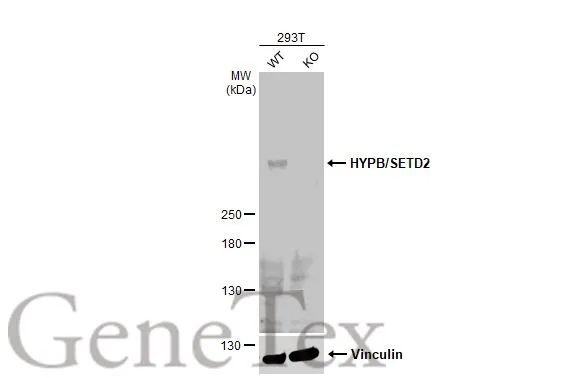 Wild-type (WT) and HYPB/SETD2 knockout (KO) 293T cell extracts (30 μg) were separated by 5% SDS-PAGE, and the membrane was blotted with HYPB/SETD2 antibody (GTX127905) diluted at 1:500. The HRP-conjugated anti-rabbit IgG antibody (GTX213110-01) was used to detect the primary antibody.