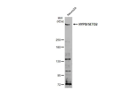 Whole cell extract (30 μg) was separated by 5% SDS-PAGE, and the membrane was blotted with HYPB/SETD2 antibody (GTX127906) diluted at 1:1000. The HRP-conjugated anti-rabbit IgG antibody (GTX213110-01) was used to detect the primary antibody.