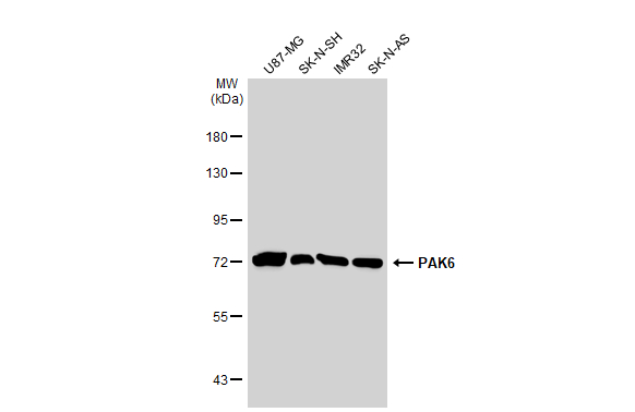 Various whole cell extracts (30 μg) were separated by 7.5% SDS-PAGE, and the membrane was blotted with PAK6 antibody (GTX127915) diluted at 1:1000. The HRP-conjugated anti-rabbit IgG antibody (GTX213110-01) was used to detect the primary antibody.