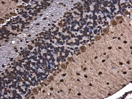 hnRNP A2B1 antibody