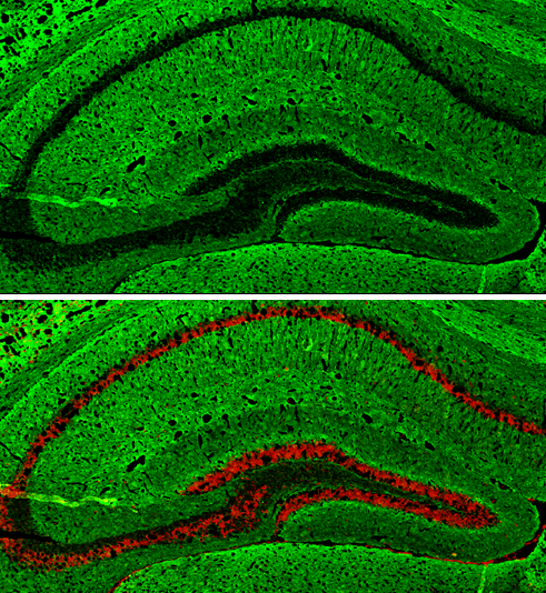 Anti-GAP43 antibody (GTX127937) | GeneTex