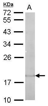 IL22 antibody detects Il22 protein by Western blot analysis. A. 50 μg mouse spleen lysate/extract 12 % SDS-PAGE IL22 antibody (GTX127938) dilution: 1:10000