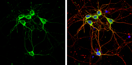 CaMKII alpha antibody