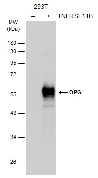 Non-transfected (–) and transfected (+) 293T whole cell extracts (30 μg) were separated by 10% SDS-PAGE, and the membrane was blotted with OPG antibody (GTX127948) diluted at 1:1500. The HRP-conjugated anti-rabbit IgG antibody (GTX213110-01) was used to detect the primary antibody. Non-transfected (–) and transfected (+) 293T whole cell extracts (30 μg) were separated by 10% SDS-PAGE, and the membrane was blotted with OPG antibody (GTX127948) diluted at 1:1500. The HRP-conjugated anti-rabbit IgG antibody (GTX213110-01) was used to detect the primary antibody.