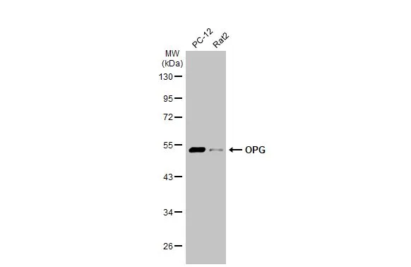 Various whole cell extracts (30 μg) were separated by 10% SDS-PAGE, and the membrane was blotted with OPG antibody (GTX127948) diluted at 1:500. The HRP-conjugated anti-rabbit IgG antibody (GTX213110-01) was used to detect the primary antibody. Various whole cell extracts (30 μg) were separated by 10% SDS-PAGE, and the membrane was blotted with OPG antibody (GTX127948) diluted at 1:500. The HRP-conjugated anti-rabbit IgG antibody (GTX213110-01) was used to detect the primary antibody.