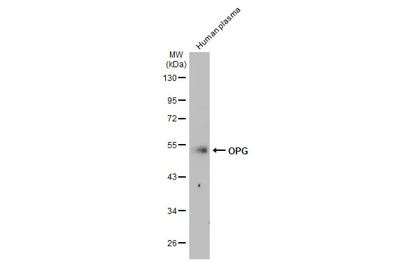 Human plasma (30 μg) was separated by 10% SDS-PAGE, and the membrane was blotted with OPG antibody (GTX127948) diluted at 1:1000. The HRP-conjugated anti-rabbit IgG antibody (GTX213110-01) was used to detect the primary antibody, and the signal was developed with Trident ECL plus-Enhanced.