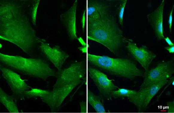 DCTD antibody detects DCTD protein at nucleus, cytoplasm and endoplasmic reticulum by immunofluorescent analysis. Sample: SK-N-SH cells were fixed in 4% paraformaldehyde at RT for 15 min. Green: DCTD stained by DCTD antibody (GTX127971) diluted at 1:500. Blue: Fluoroshield with DAPI (GTX30920).