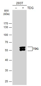Non-transfected (–) and transfected (+) 293T whole cell extracts (30 μg) were separated by 10% SDS-PAGE, and the membrane was blotted with TDG antibody (GTX127975) diluted at 1:10000. The HRP-conjugated anti-rabbit IgG antibody (GTX213110-01) was used to detect the primary antibody.
