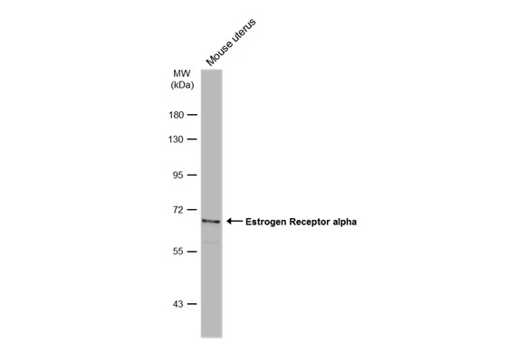 Mouse tissue extract (50 μg) was separated by 7.5% SDS-PAGE, and the membrane was blotted with Estrogen Receptor alpha antibody (GTX127978) diluted at 1:1000. The HRP-conjugated anti-rabbit IgG antibody (GTX213110-01) was used to detect the primary antibody.