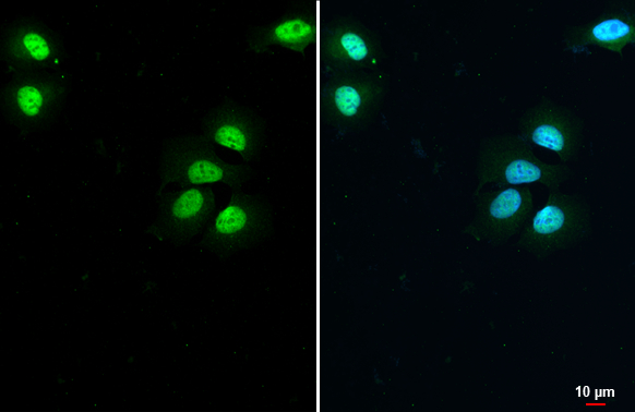 Estrogen Receptor alpha antibody detects Estrogen Receptor alpha protein at nucleus by immunofluorescent analysis. Sample: MCF-7 cells were fixed in 4% paraformaldehyde at RT for 15 min. Green: Estrogen Receptor alpha stained by Estrogen Receptor alpha antibody (GTX127978) diluted at 1:500.