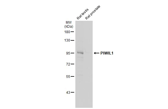 Various tissue extracts (50 μg) were separated by 7.5% SDS-PAGE, and the membrane was blotted with PIWIL1 antibody (GTX128020) diluted at 1:1000. The HRP-conjugated anti-rabbit IgG antibody (GTX213110-01) was used to detect the primary antibody, and the signal was developed with Trident ECL plus-Enhanced.