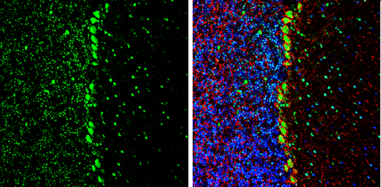 CFDP1 antibody