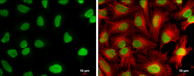 CFDP1 antibody