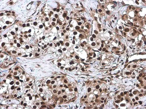 CFDP1 antibody