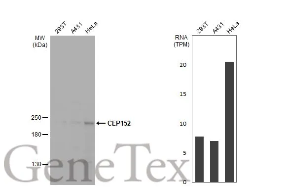 Various whole cell extracts (30 μg) were separated by 5% SDS-PAGE, and the membrane was blotted with CEP152 antibody (GTX128027) diluted at 1:500. The HRP-conjugated anti-rabbit IgG antibody (GTX213110-01) was used to detect the primary antibody. Corresponding RNA expression data for the same cell lines are based on Human Protein Atlas program.