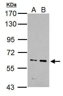IKZF4 antibody detects IKZF4 protein by western blot analysis.