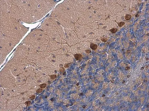 PSRC1 antibody detects PSRC1 protein at cytoplasm by immunohistochemical analysis. Sample: Paraffin-embedded mouse brain. PSRC1 stained by PSRC1 antibody (GTX128047) diluted at 1:500.
 Antigen Retrieval: Citrate buffer, pH 6.0, 15 min