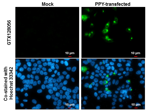Pancreatic Polypeptide antibody detects Pancreatic Polypeptide protein at cytoplasm by immunofluorescent analysis.