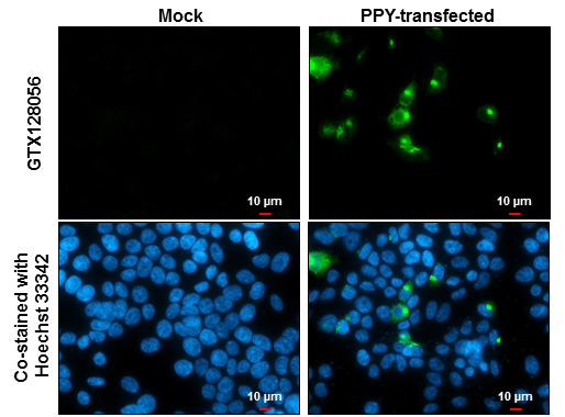 Pancreatic Polypeptide antibody detects Pancreatic Polypeptide protein at cytoplasm by immunofluorescent analysis. Sample: Mock and transfected 293T cells were fixed in 4% paraformaldehyde at RT for 15 min. Green: Pancreatic Polypeptide stained by Pancreatic Polypeptide antibody (GTX128056) diluted at 1:2000. Blue: Hoechst 33342 staining. Scale bar= 10μm.