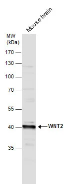 WNT2 antibody detects WNT2 protein by western blot analysis. Mouse tissue extracts (50 μg) was separated by 10% SDS-PAGE, and the membrane was blotted with WNT2 antibody (GTX128098) diluted at 1:500.