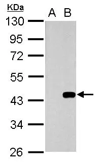 WNT3 antibody detects WNT3 protein by Western blot analysis. A. 30 μg 293T whole cell lysate/extract B. 30 μg whole cell lysate/extract of Wnt3-transfected 293T cells 10 % SDS-PAGE WNT3 antibody (GTX128100) dilution: 1:5000