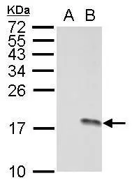 Histone H3S10ph (phospho Ser10) antibody detects Histone H3S10ph (phospho Ser10) protein on zebrafish by whole mount immunohistochemical analysis.