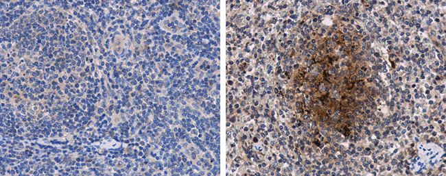 Porcine circovirus type 2 Capsid antibody didn't detects PCV2 at macrophages on spleen by immunohistochemical analysis.