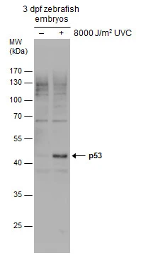 Tp53 antibody detects Tp53 protein on UV-irradiated whole-mount zebrafish embryos (right panel) by immunohistochemical analysis. Sample: Paraformaldehyde-fixed zebrafish embryos. Tp53 antibody (GTX128135) dilution: 1:200. 