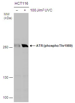 Untreated (–) and treated (+) HCT116 whole cell extracts (30 μg) were separated by 5% SDS-PAGE, and the membrane was blotted with ATR (phospho Thr1989) antibody (GTX128145) diluted at 1:2000.