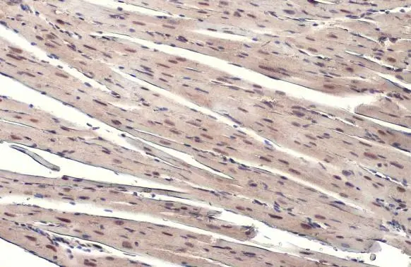 ATR (phospho Thr1989) antibody detects ATR (phospho Thr1989) protein at nucleus by immunohistochemical analysis. Sample: Paraffin-embedded mouse heart. ATR (phospho Thr1989) stained by ATR (phospho Thr1989) antibody (GTX128145) diluted at 1:1000. Antigen Retrieval: Citrate buffer, pH 6.0, 15 min