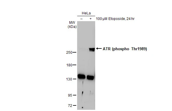 Untreated (–) and treated (+) HeLa whole cell extracts (30 μg) were separated by 5% SDS-PAGE, and the membrane was blotted with ATR (phospho Thr1989) antibody (GTX128145) diluted at 1:1000. The HRP-conjugated anti-rabbit IgG antibody (GTX213110-01) was used to detect the primary antibody.